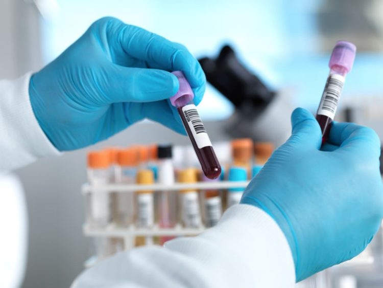 54Gene Secures $500,000 to Scale COVID-19 Testing in Nigeria